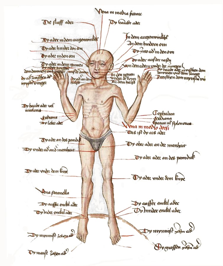 Uma figura medieval da sangria, o Aderlassmann, um homem em pé com linhas vermelhas marcando cada veia que um cirurgião poderia abrir, cada uma identificada.
